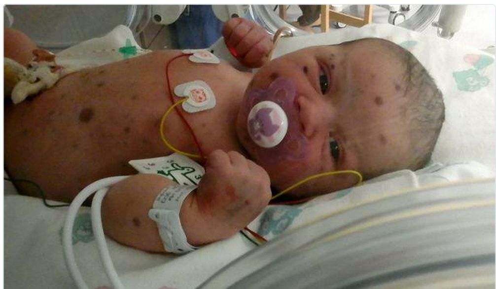 Ever Seen A Baby Born With BLUE SPOTS? If You Do, Here's ...